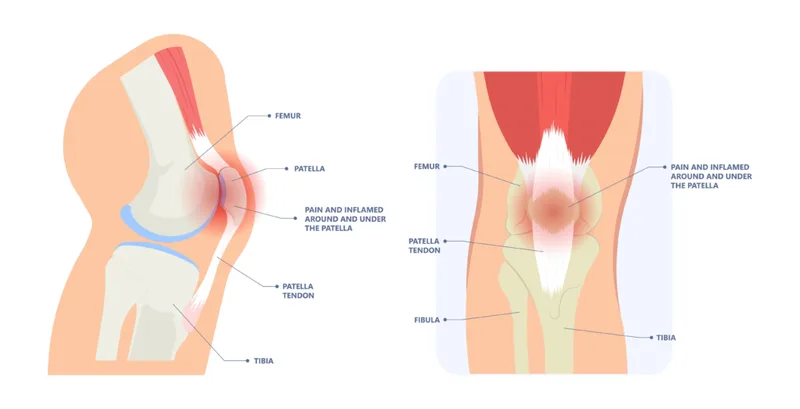 – Brookfield Chiropractor