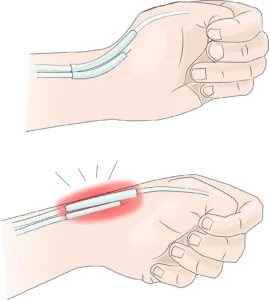 – Brookfield Chiropractor
