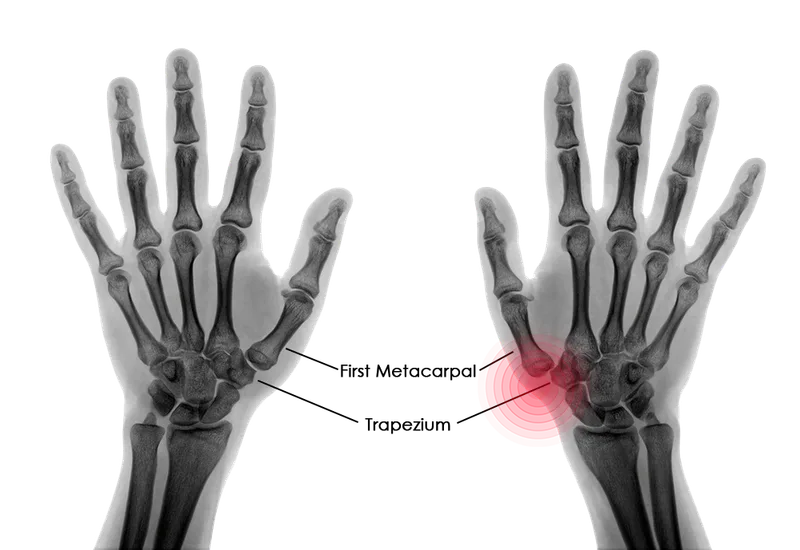 – Brookfield Chiropractor