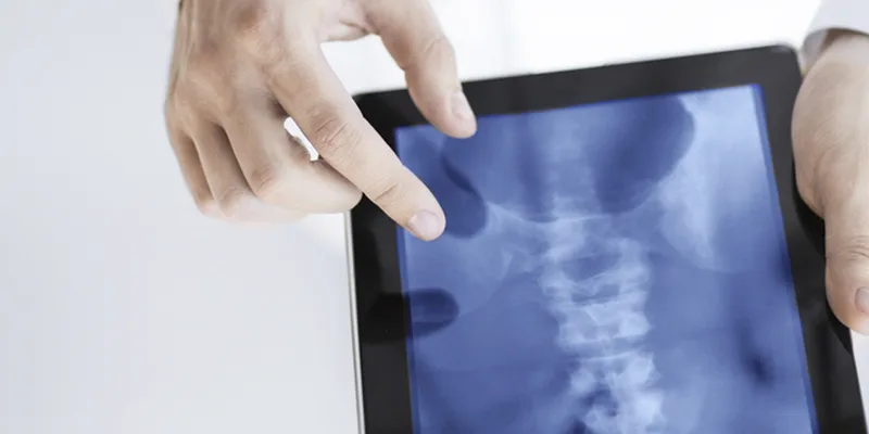 xray banner