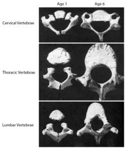– Brookfield Chiropractor