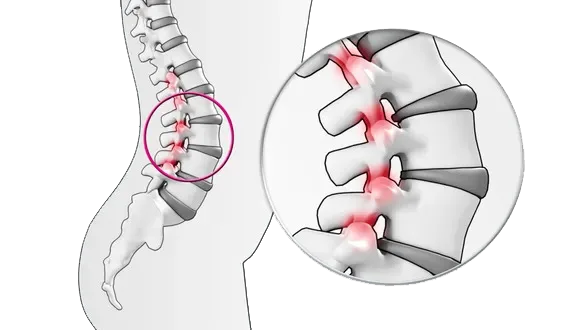 – Brookfield Chiropractor