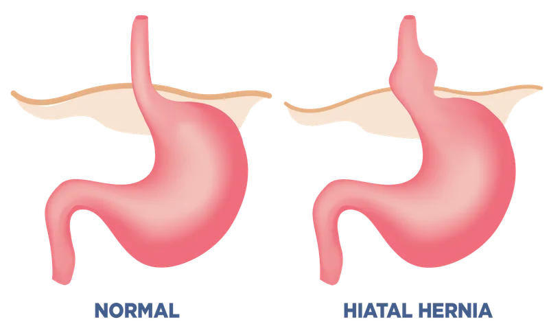 – Brookfield Chiropractor
