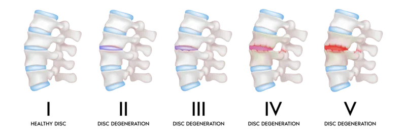 – Brookfield Chiropractor