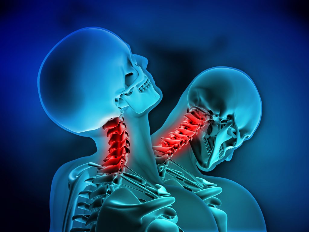 WHIPLASH! Why Car Accident Injuries Need To Be Treated With Chiropractic Care