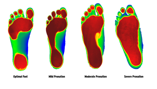 Why Do We Use Foot Levelers Custom Orthotics? – Brookfield Chiropractor