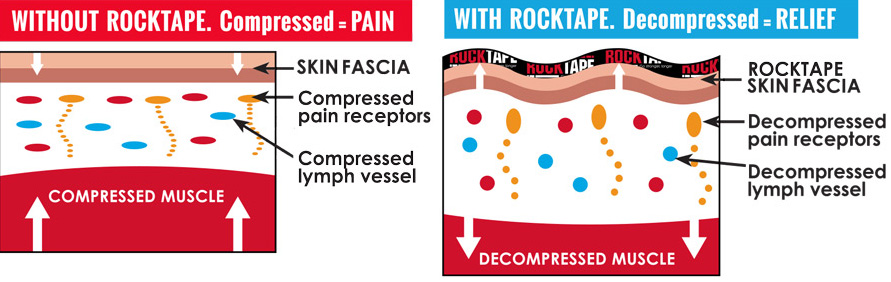 What Is RockTape & How Can It Help You? – Brookfield Chiropractor