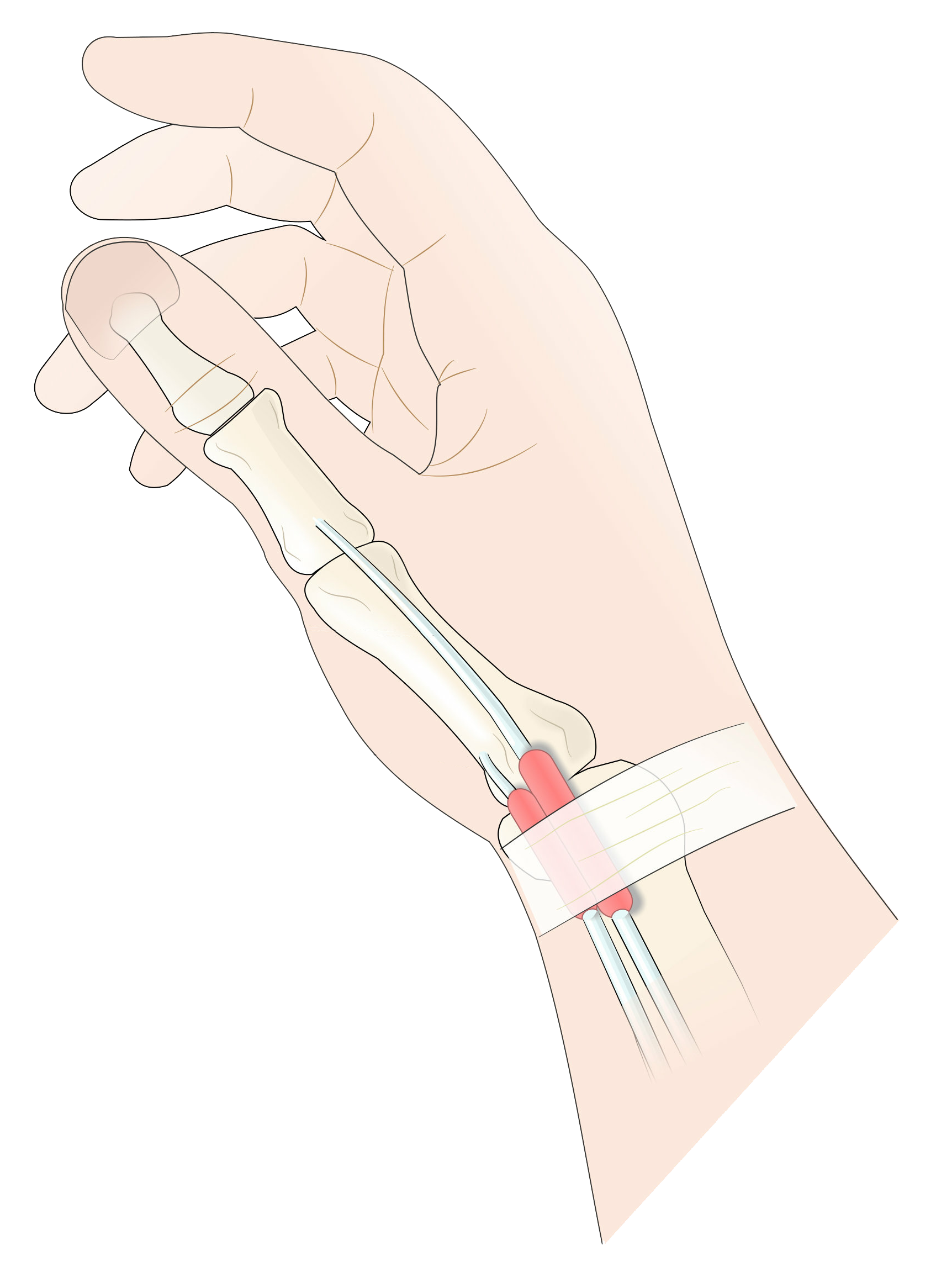 Left Thumb Pain Spiritual Meaningsocial Post Detail - qc8t3pq