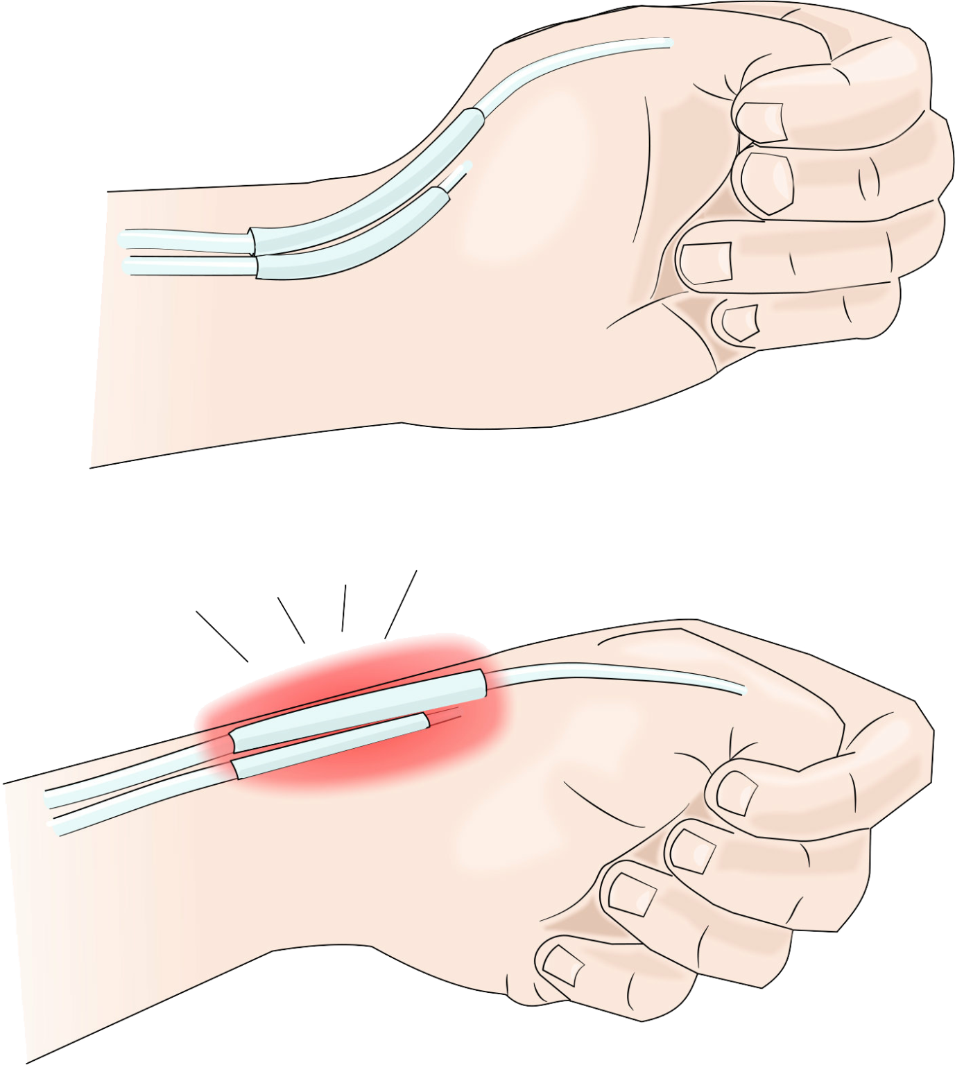 Left Thumb Pain Spiritual Meaningsocial Post Detail - mwisyt6