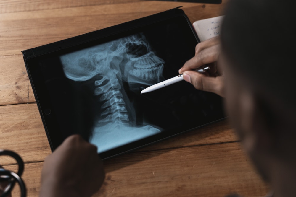 Do I Really Need X-Rays For Chiropractic Care?
