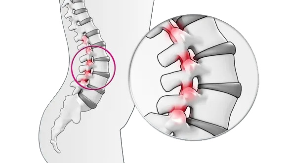 What Actually Happens When A Chiropractor 'Cracks Your Back'? – Brookfield Chiropractor